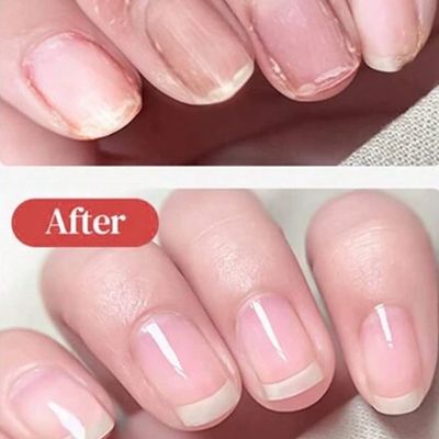 【オプション】#爪割れ #アクリル補強 ⭐️　１箇所550円