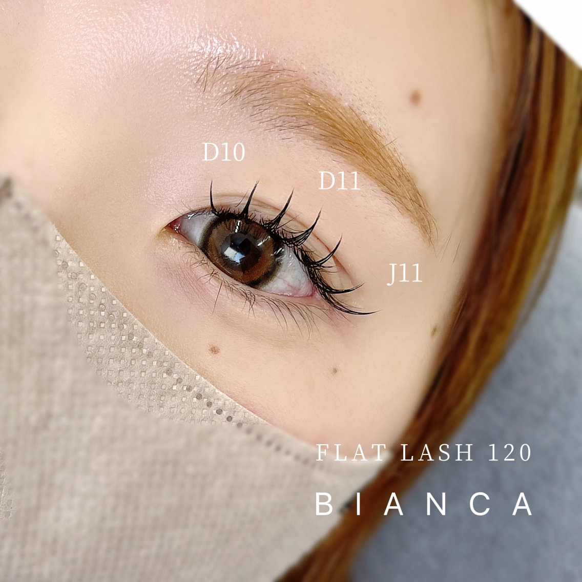bianca_m_endo