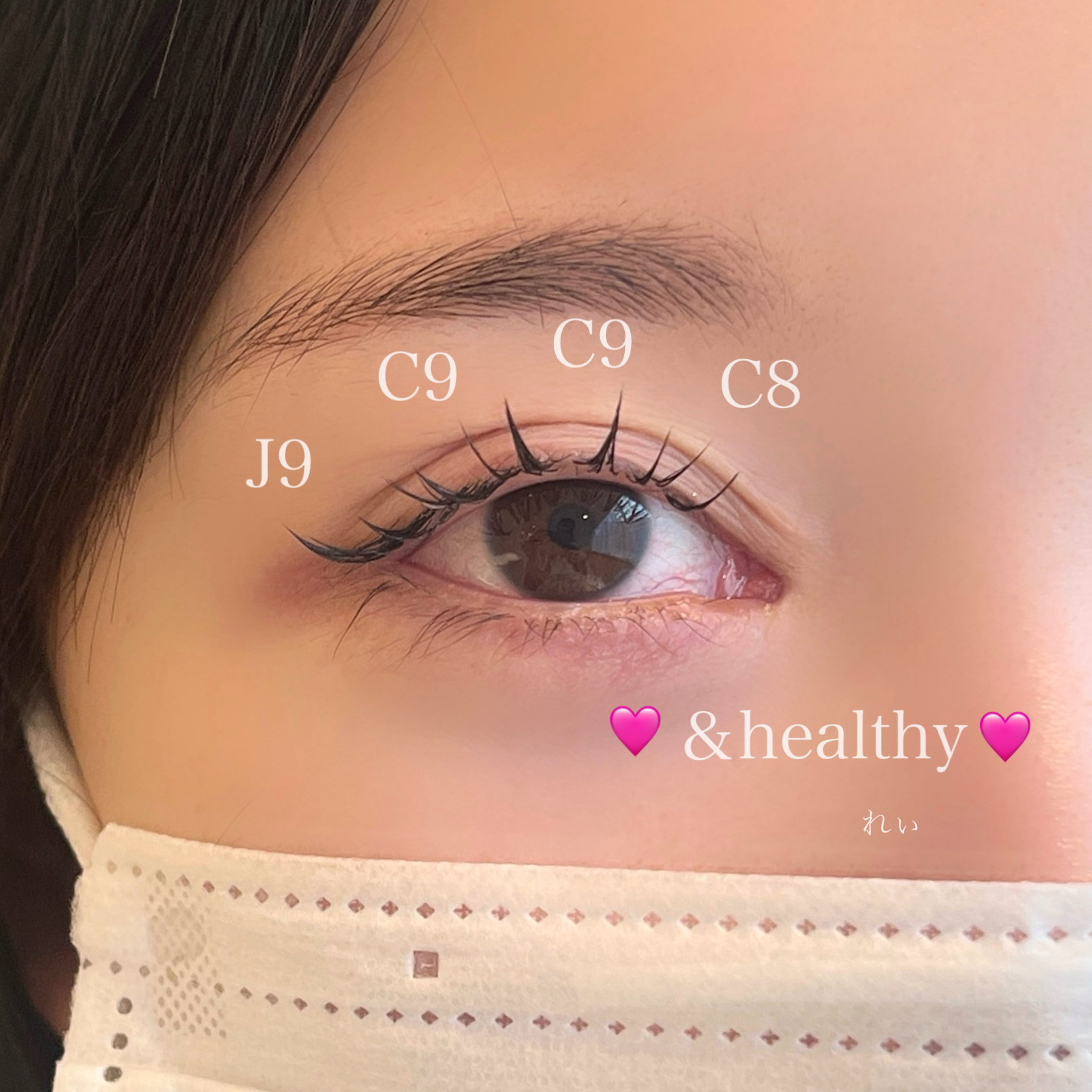 eye_rei