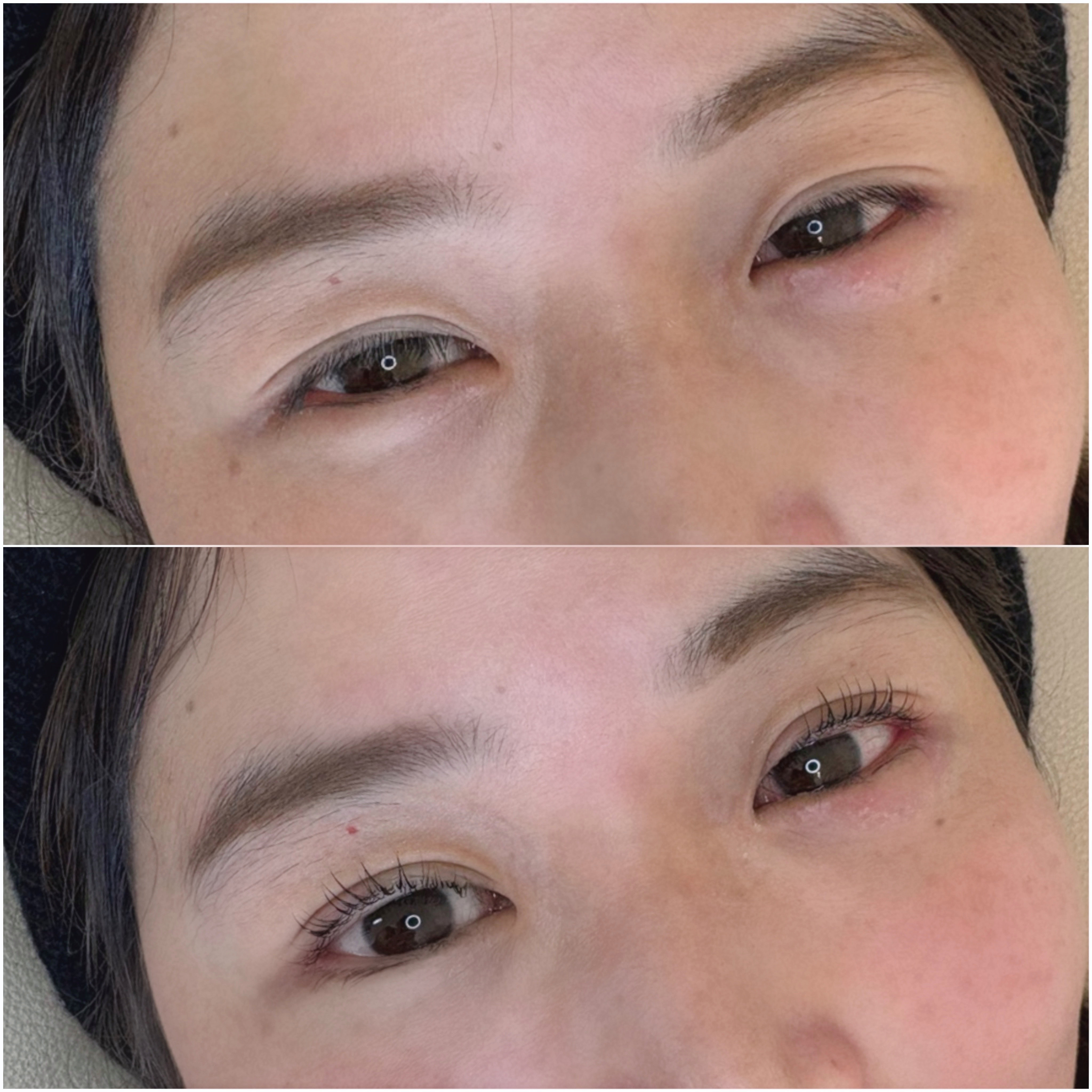 eyelist_aico