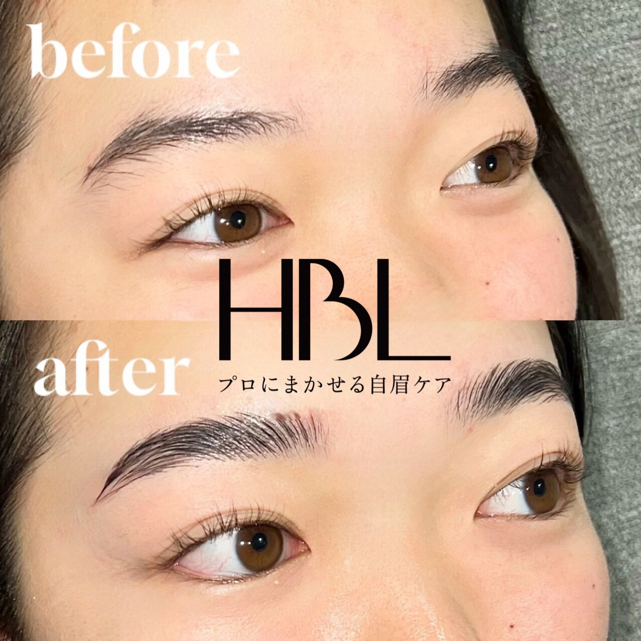 iga_EYE405