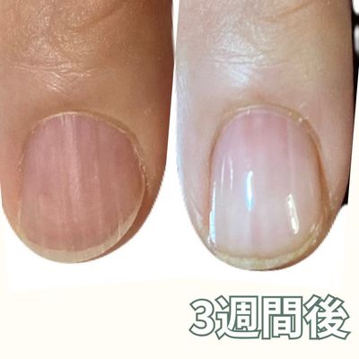 自爪育成初回「育成基本とあなたの育成ポイント」