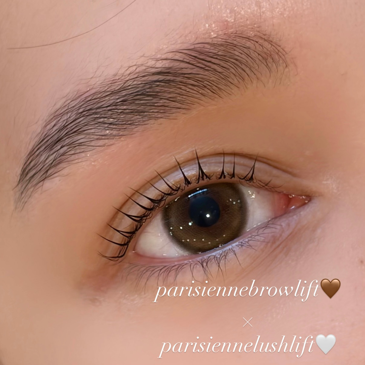 runa._trueye