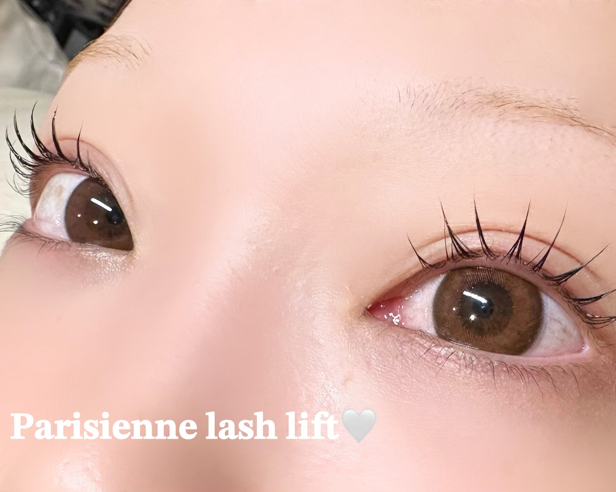 yui.y_trueye
