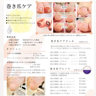 巻き爪解放ジェルワンカラー