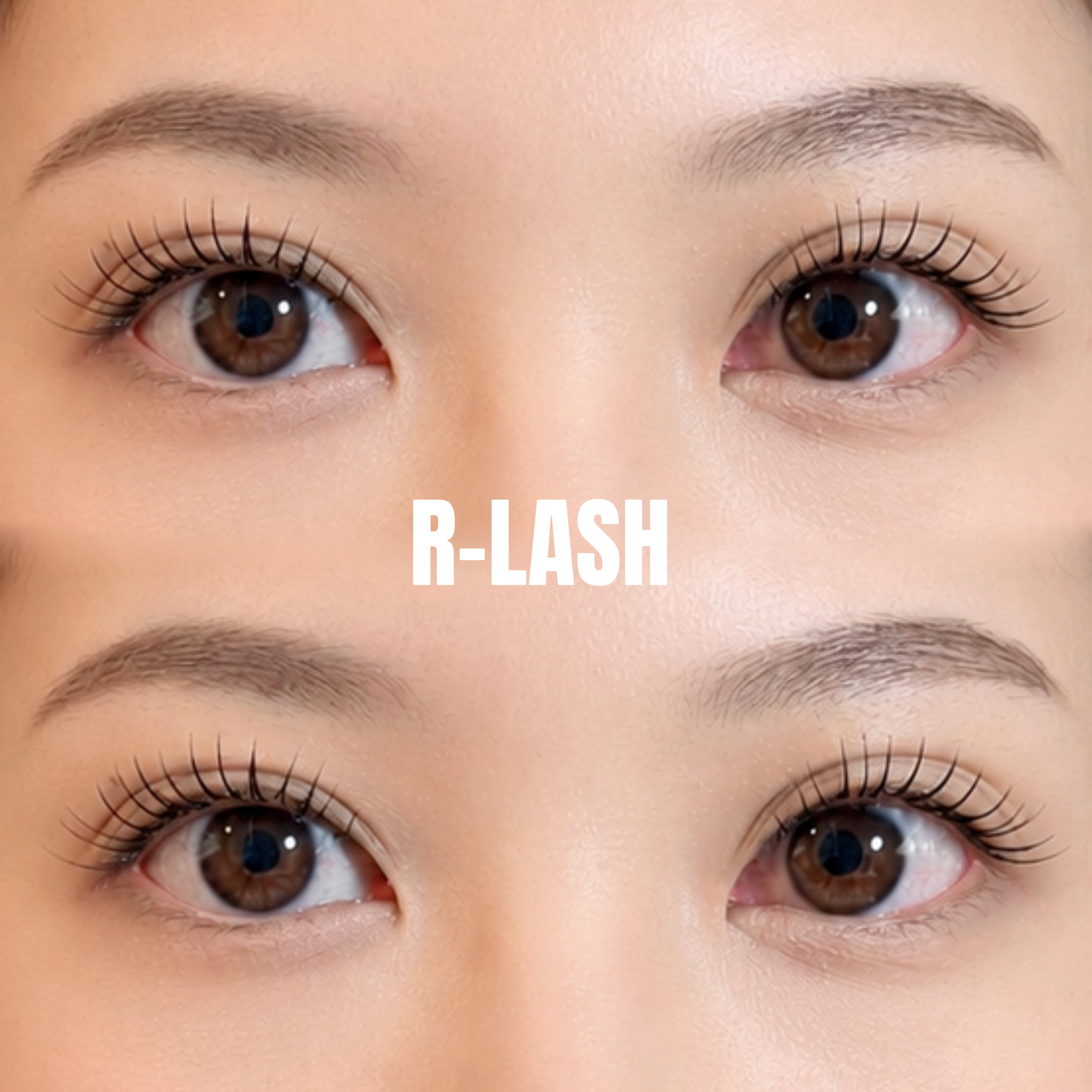 R_LASH