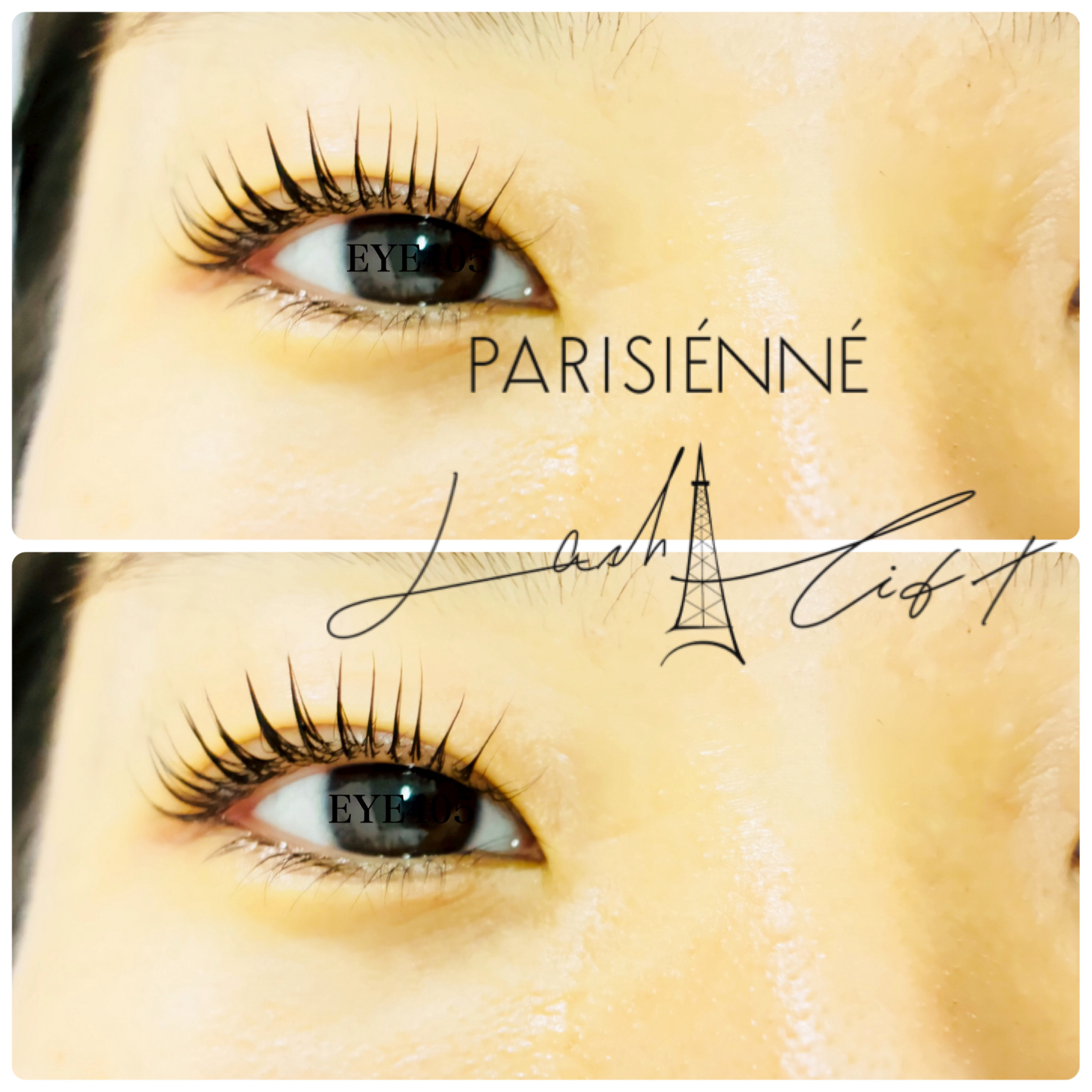 iga_EYE405