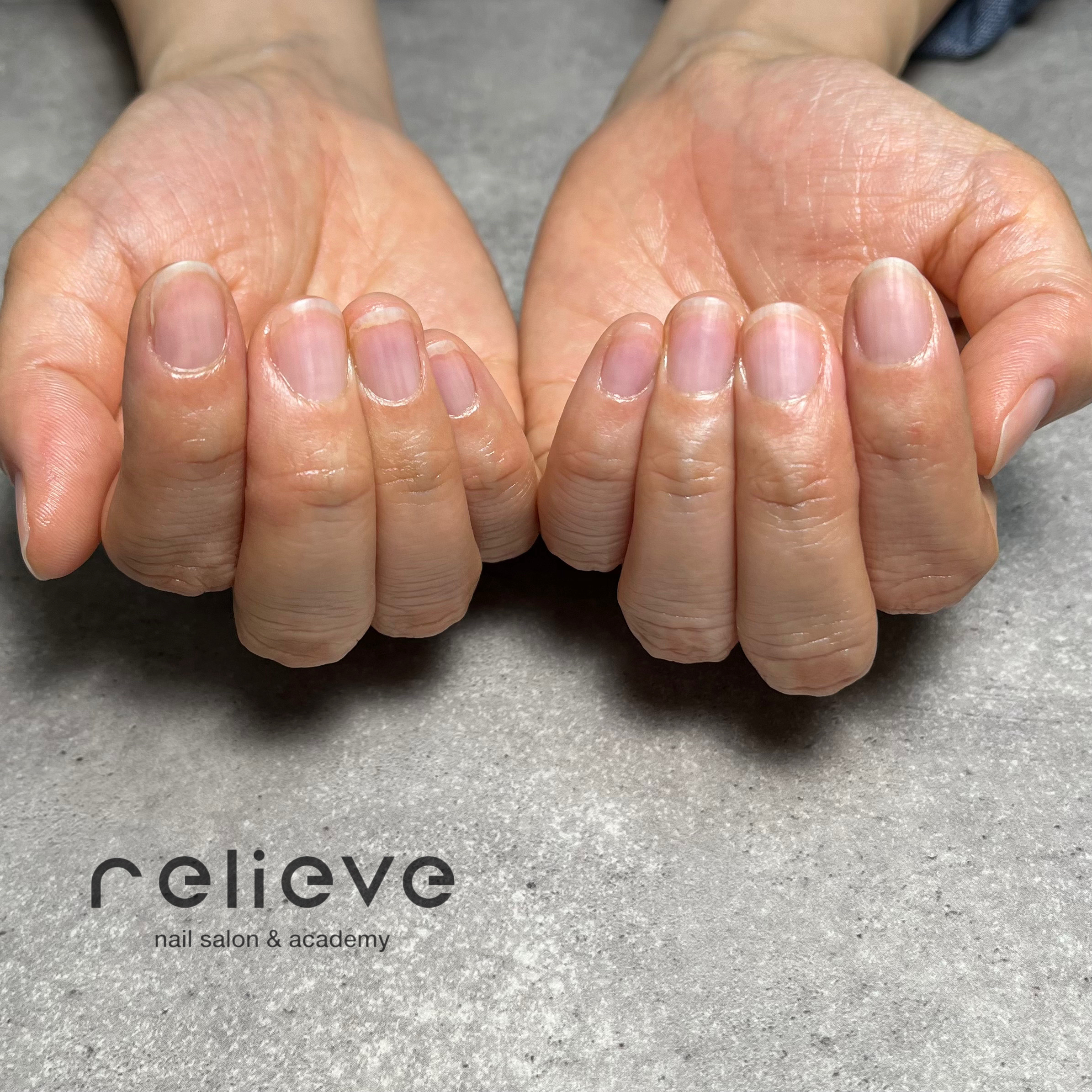 relieve