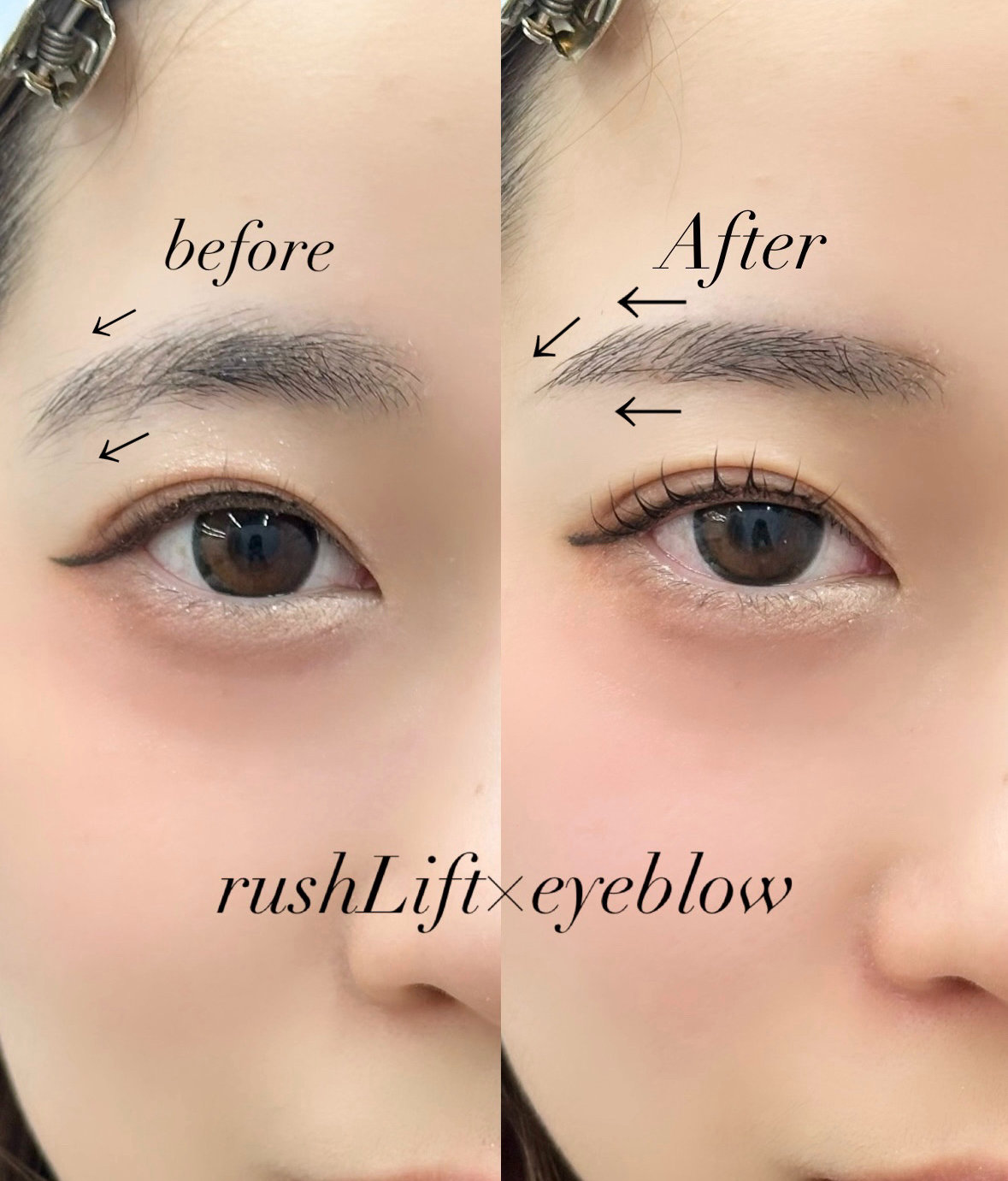 to__mo_eyelist