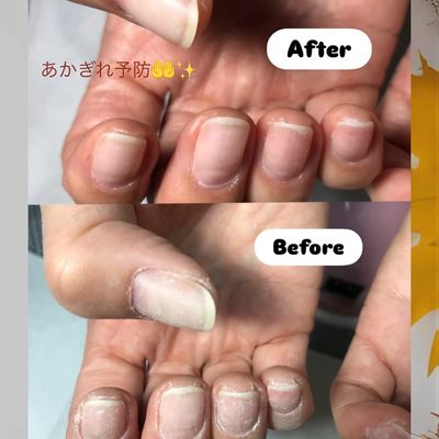 指先角質ケアのみ𓂃⟡.·