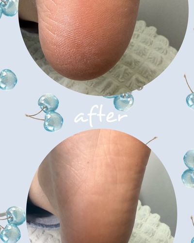 クイック角質ケア➕フットワンカラー
