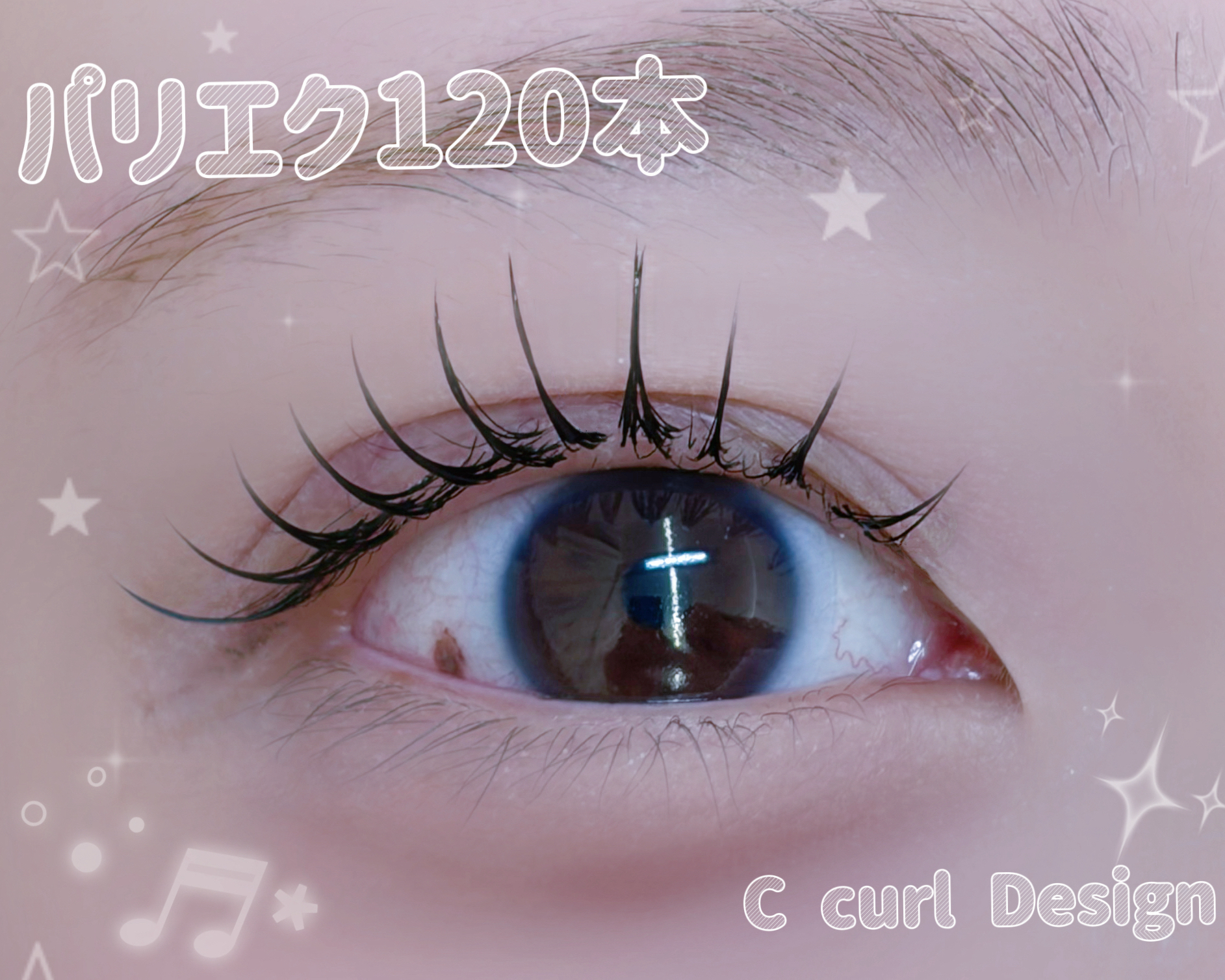 eyemo_e
