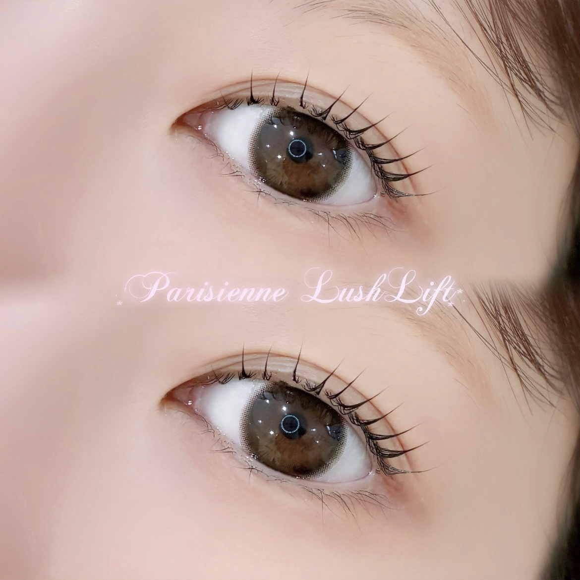 koto_trueye