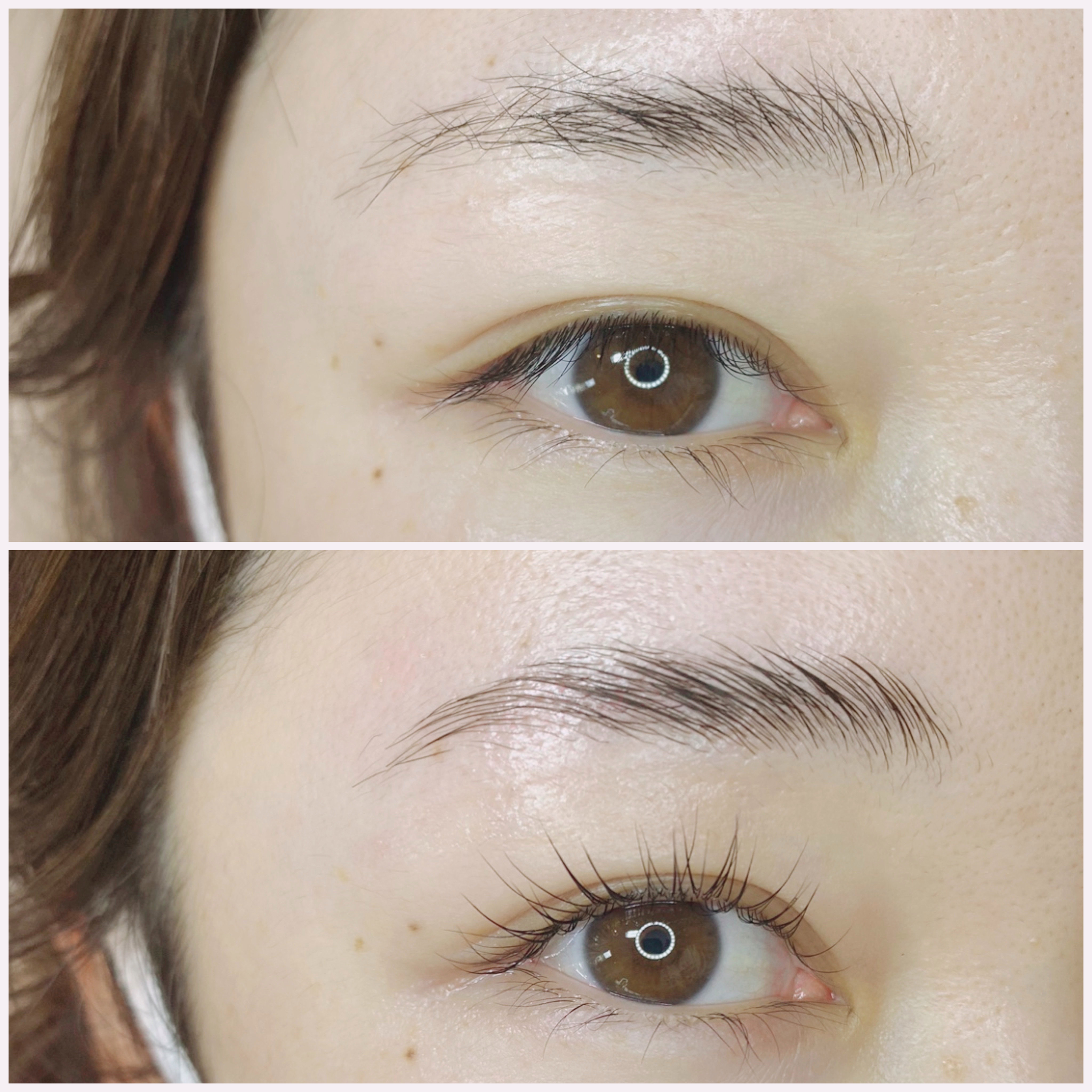 eyelist_aico