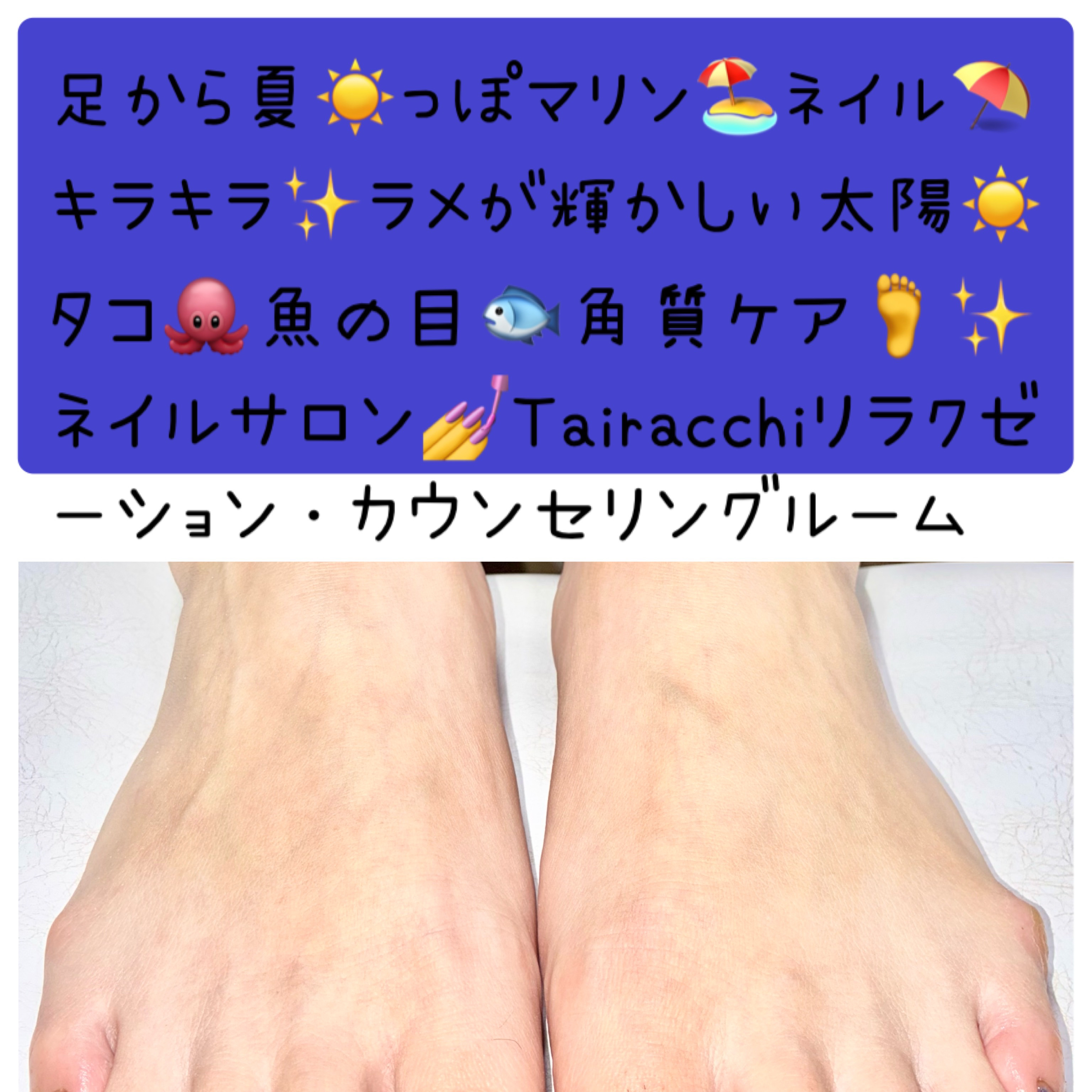 Tairacch_