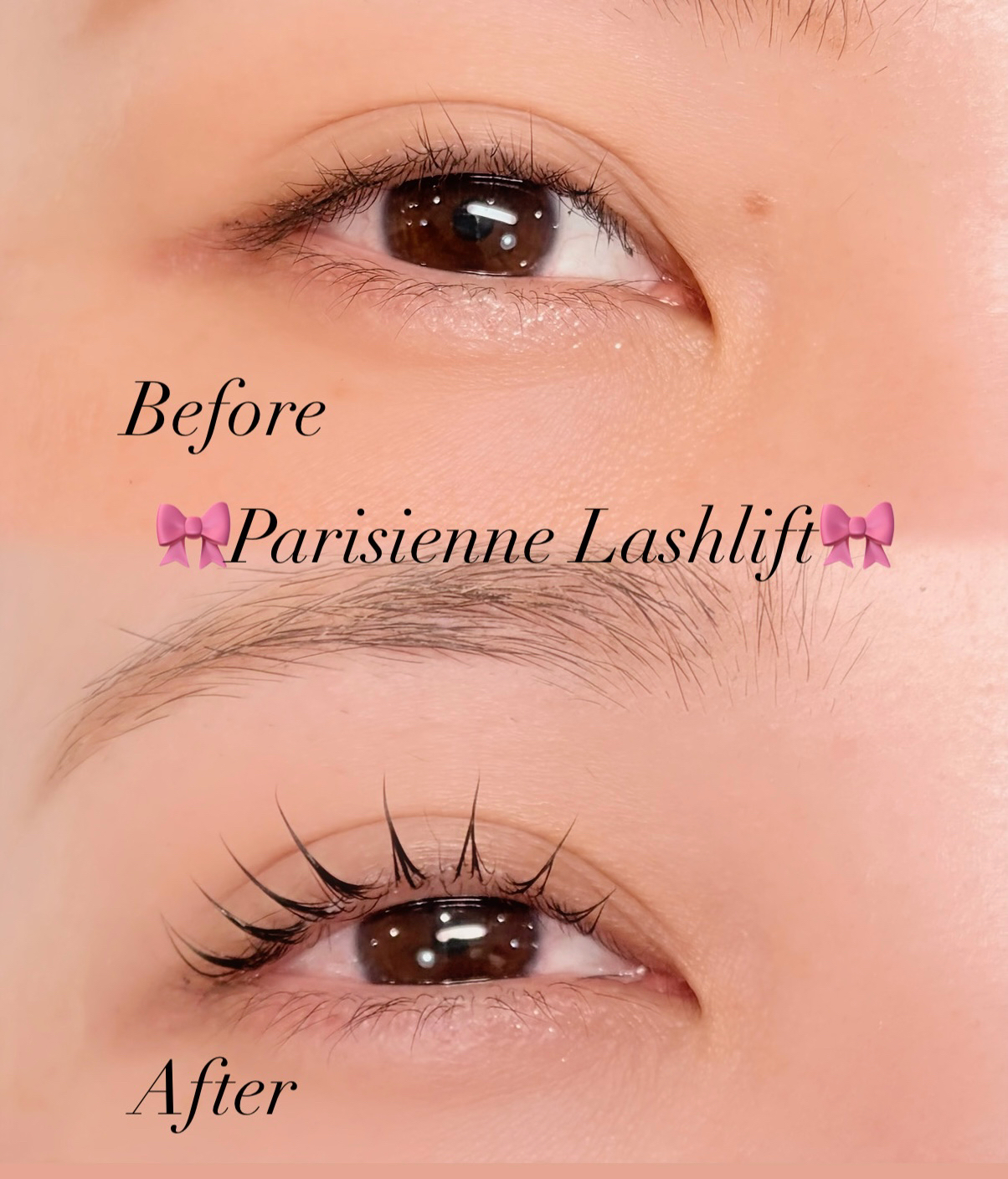 mei_trueye