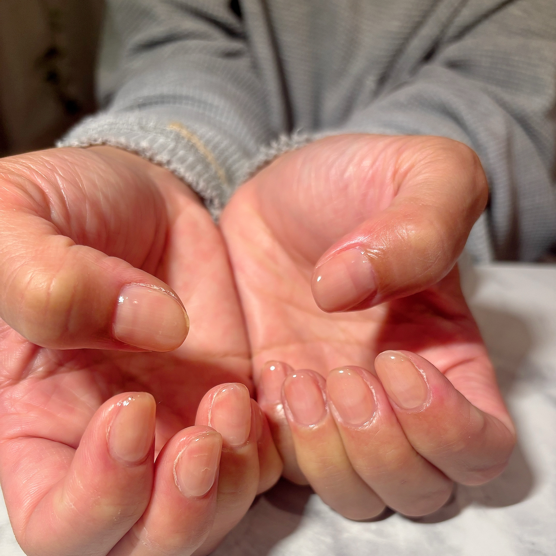 apis_nail