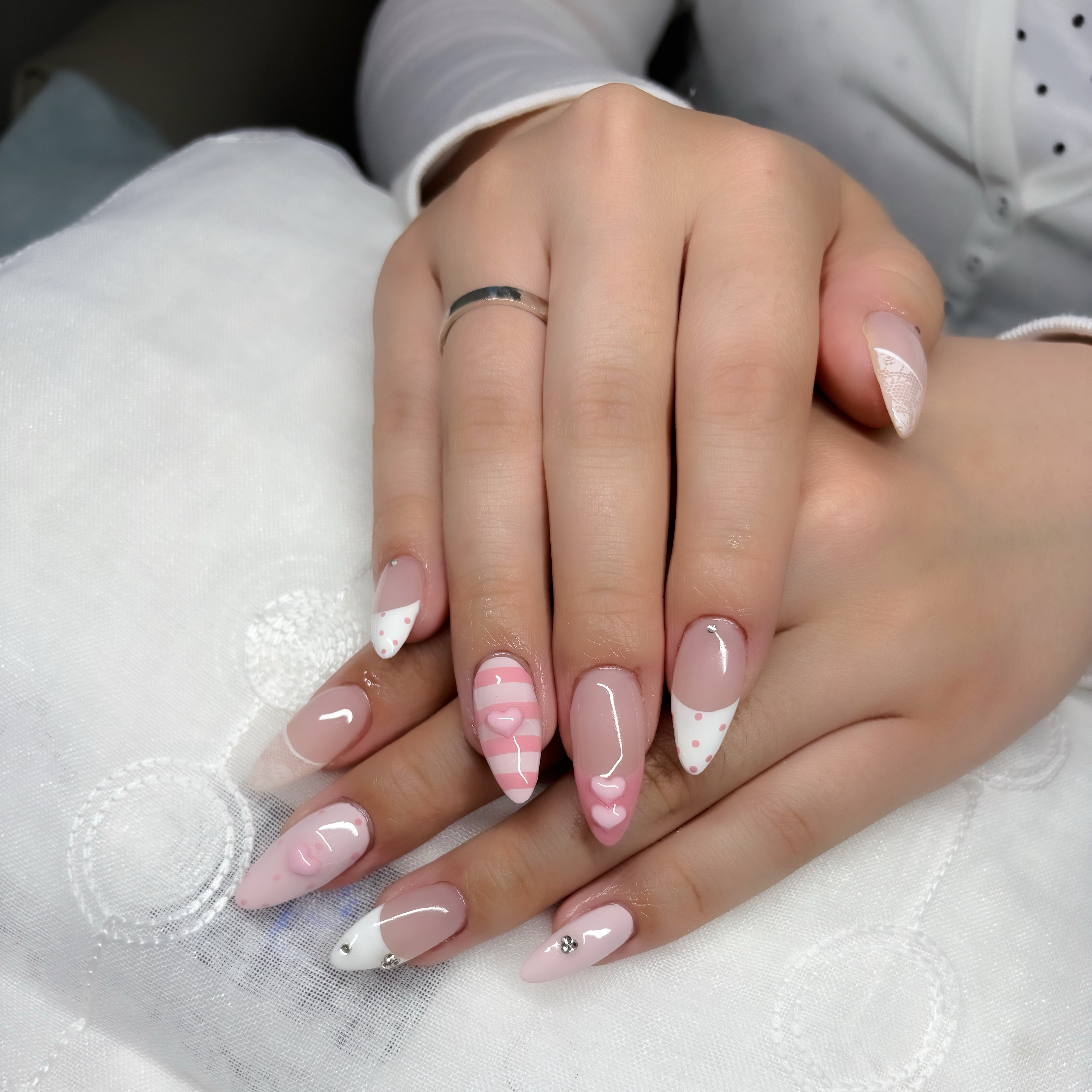 trangnail
