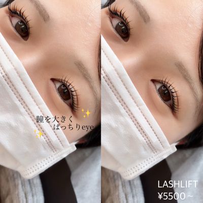 ラッシュリフト上下