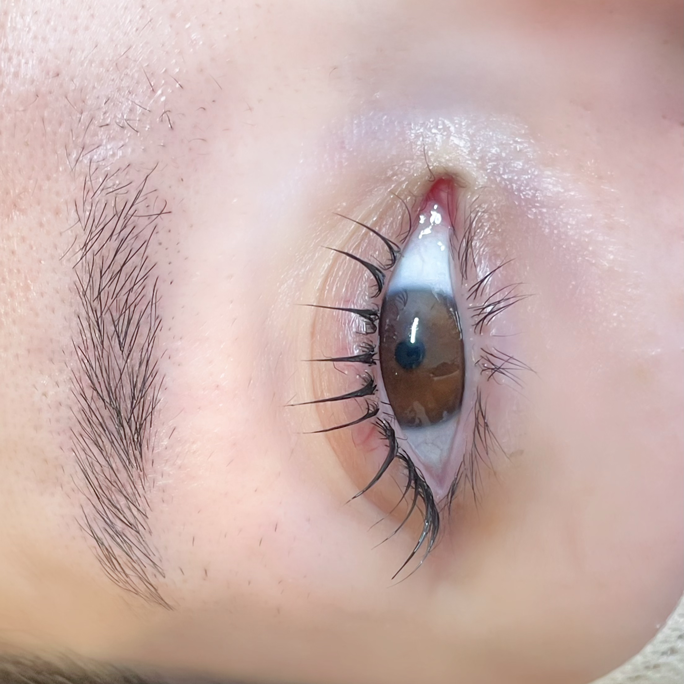 eye..hbl