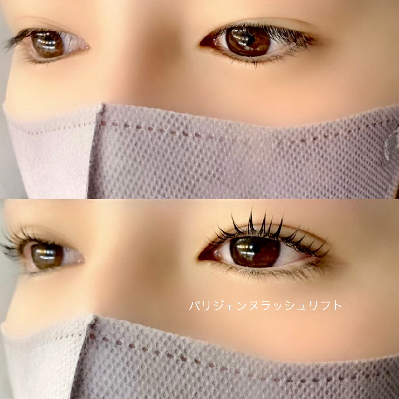 ankpil___yuumi