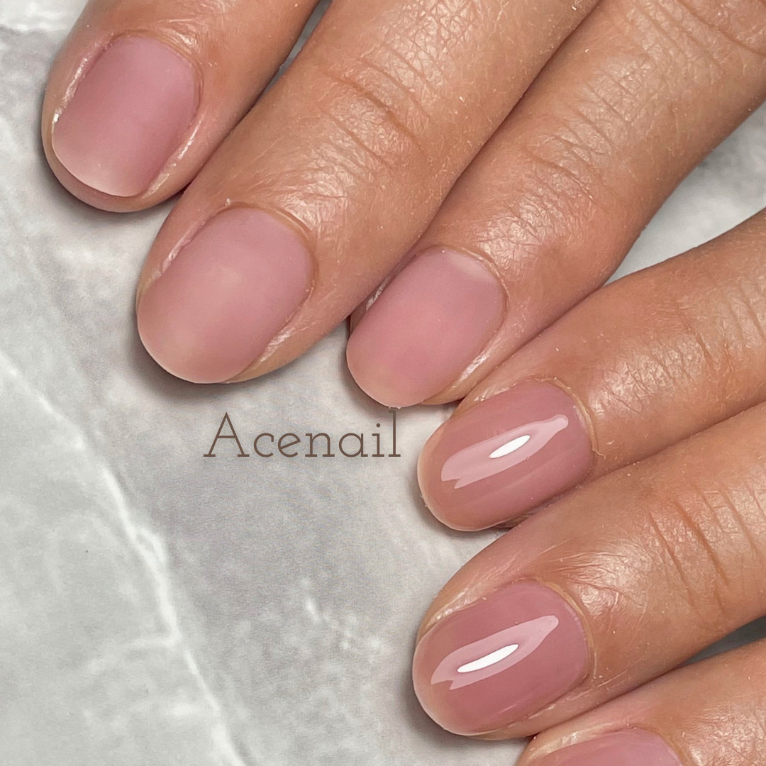 Acenail