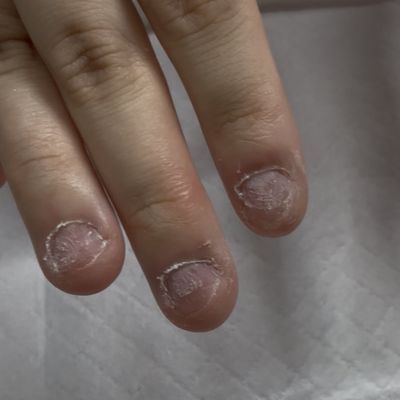 深爪矯正ネイル （深爪に悩む方のみ）ワンカラー