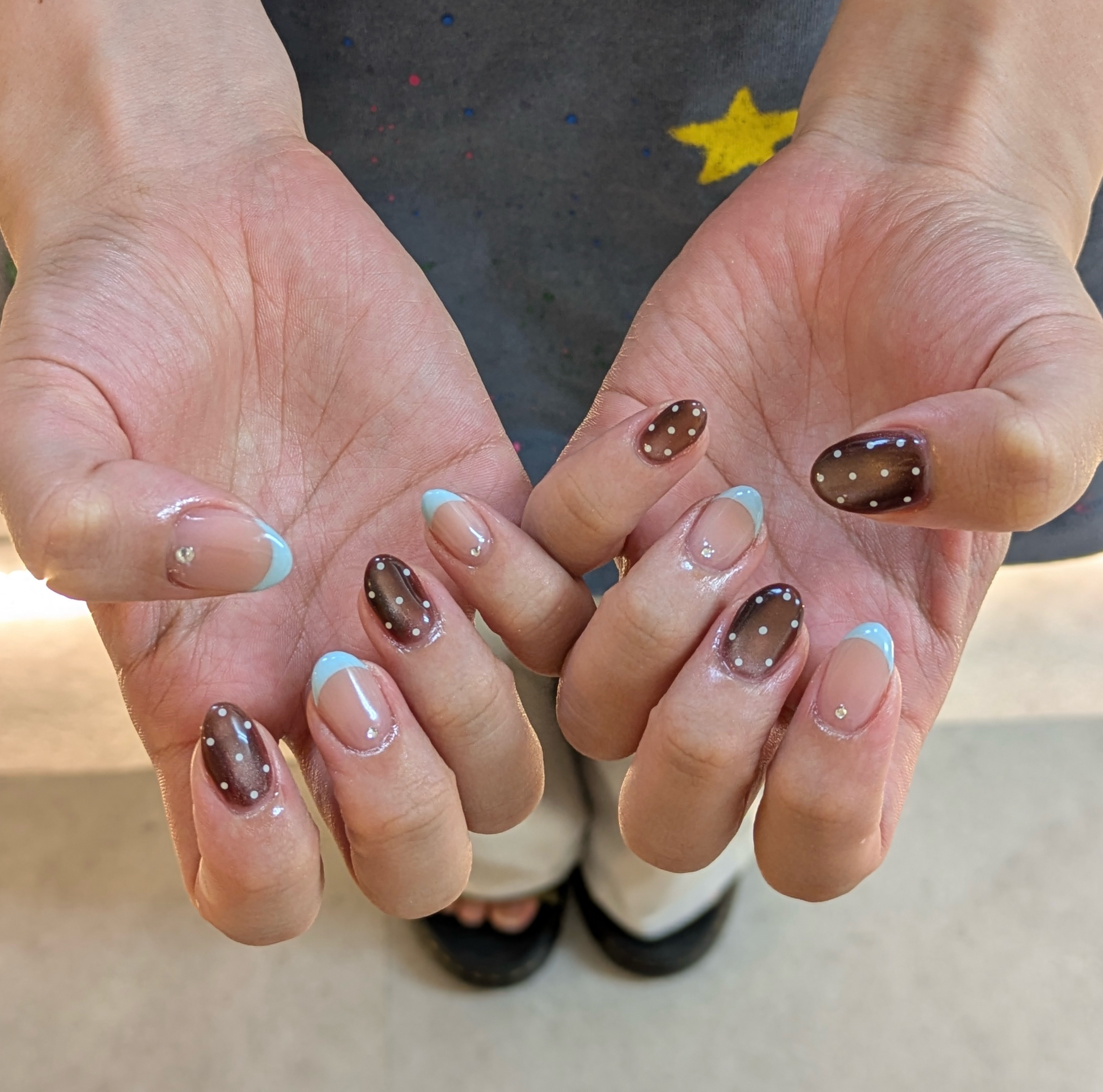 nail_trinity_scalp