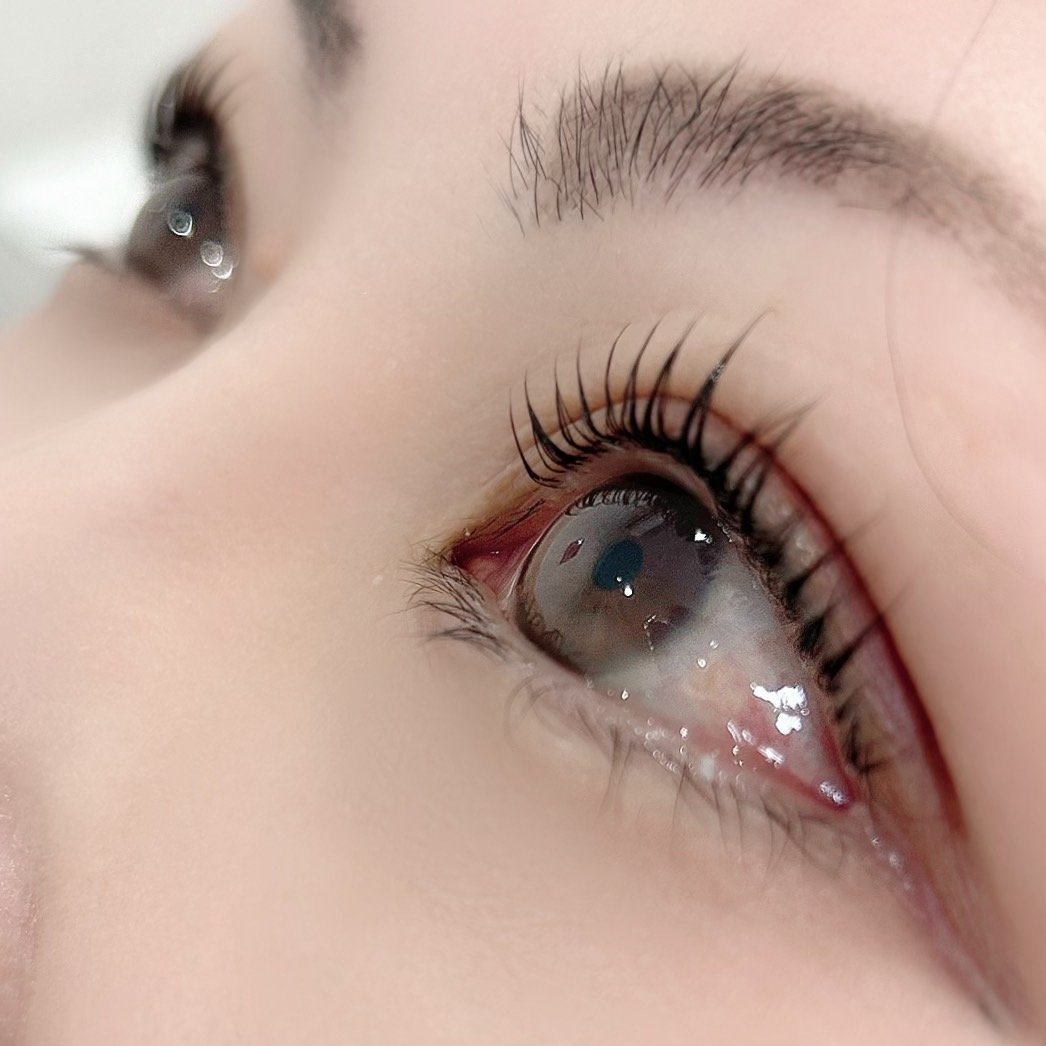 miko_eyedegin
