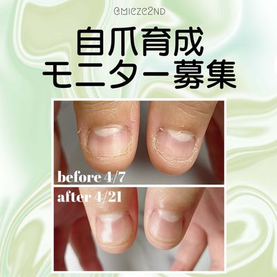 [モニター価格]自爪育成コース