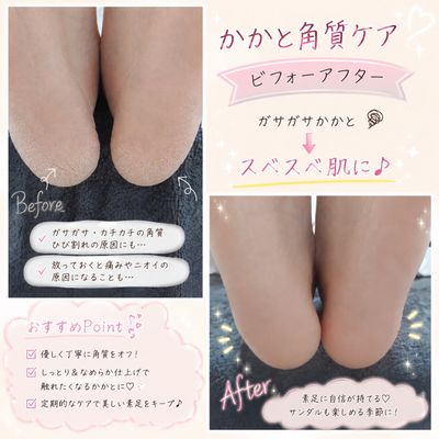 フットケア