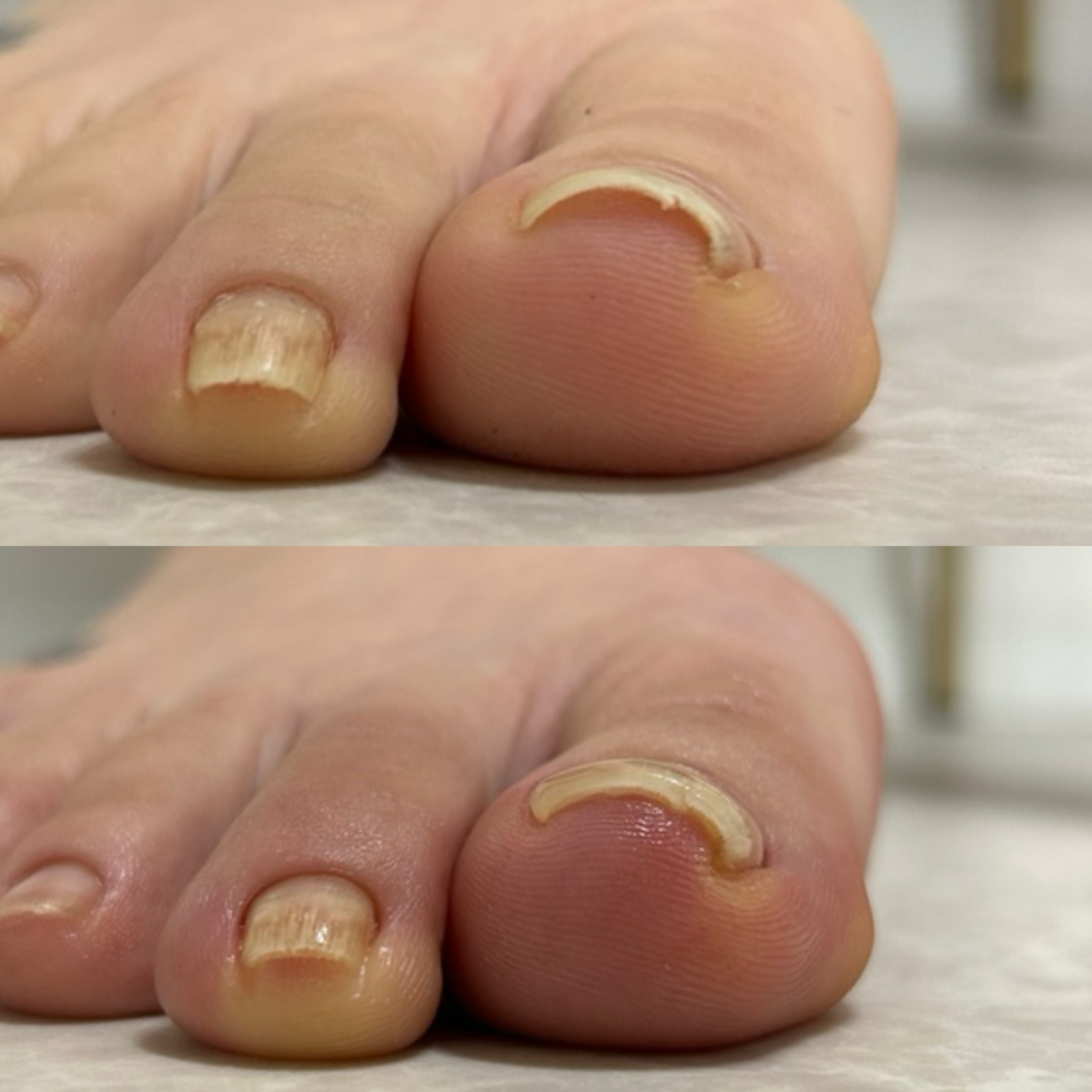 kicoco.nail