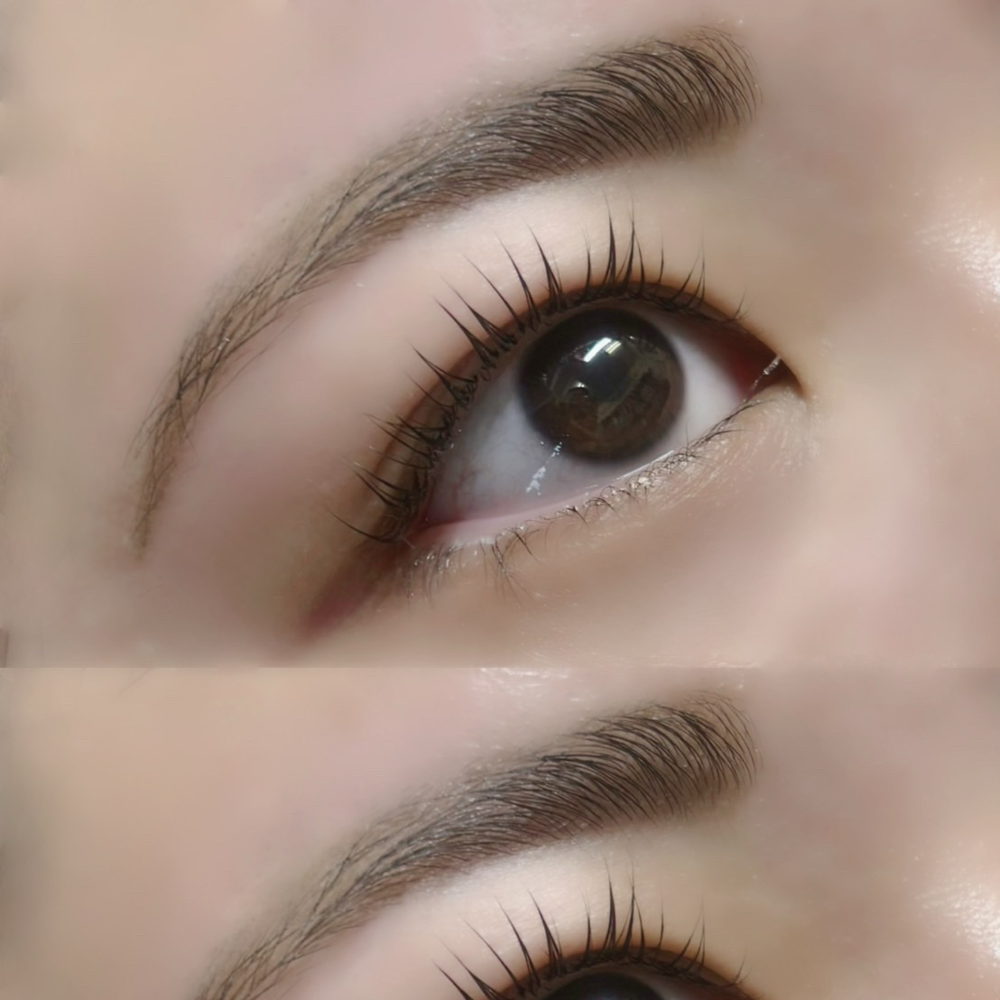 aoi__trueye