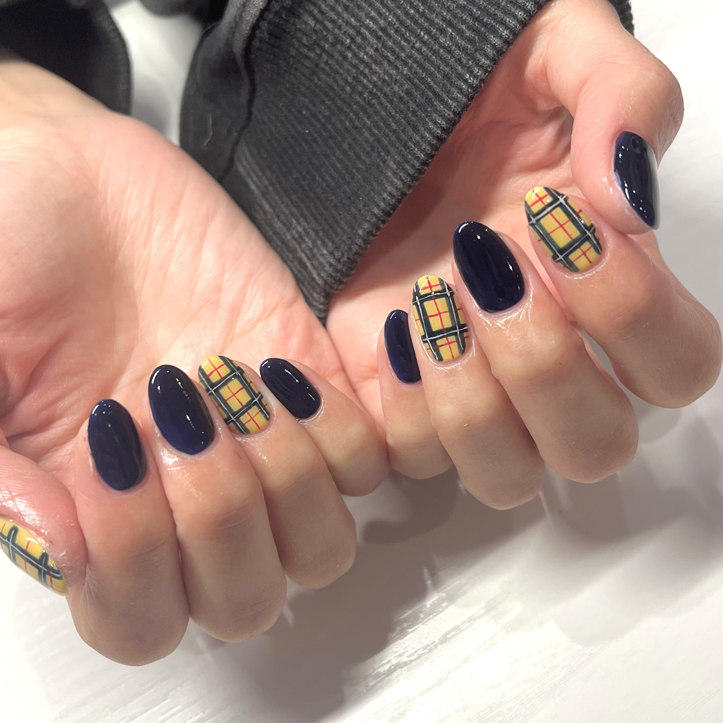 IRIS.nail