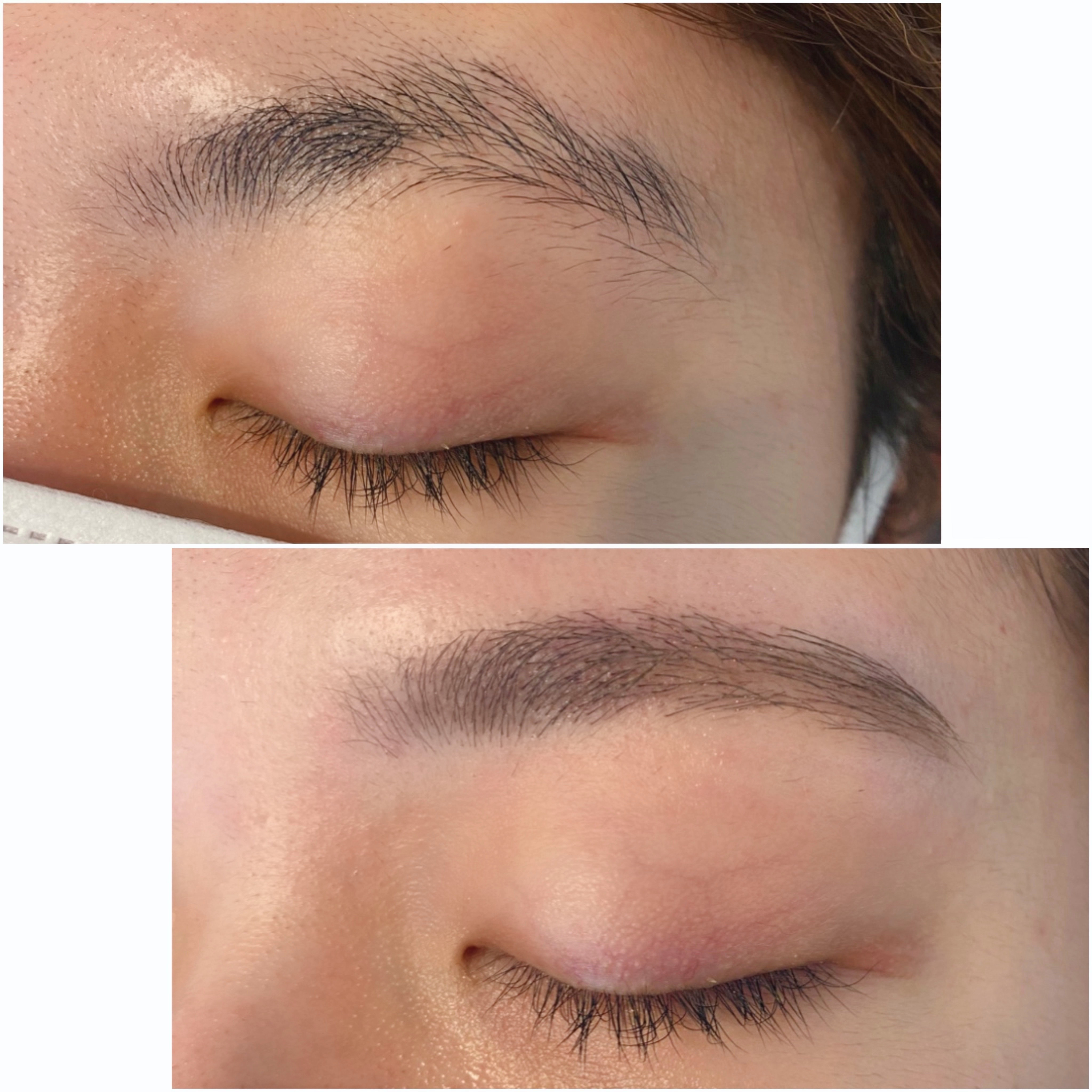 eyelist_aico