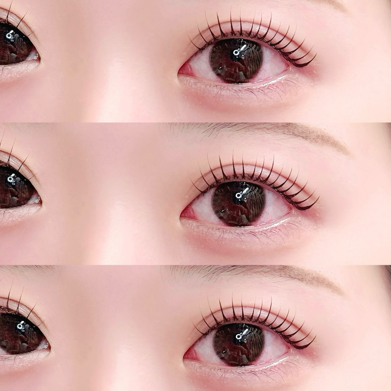 na_eye_