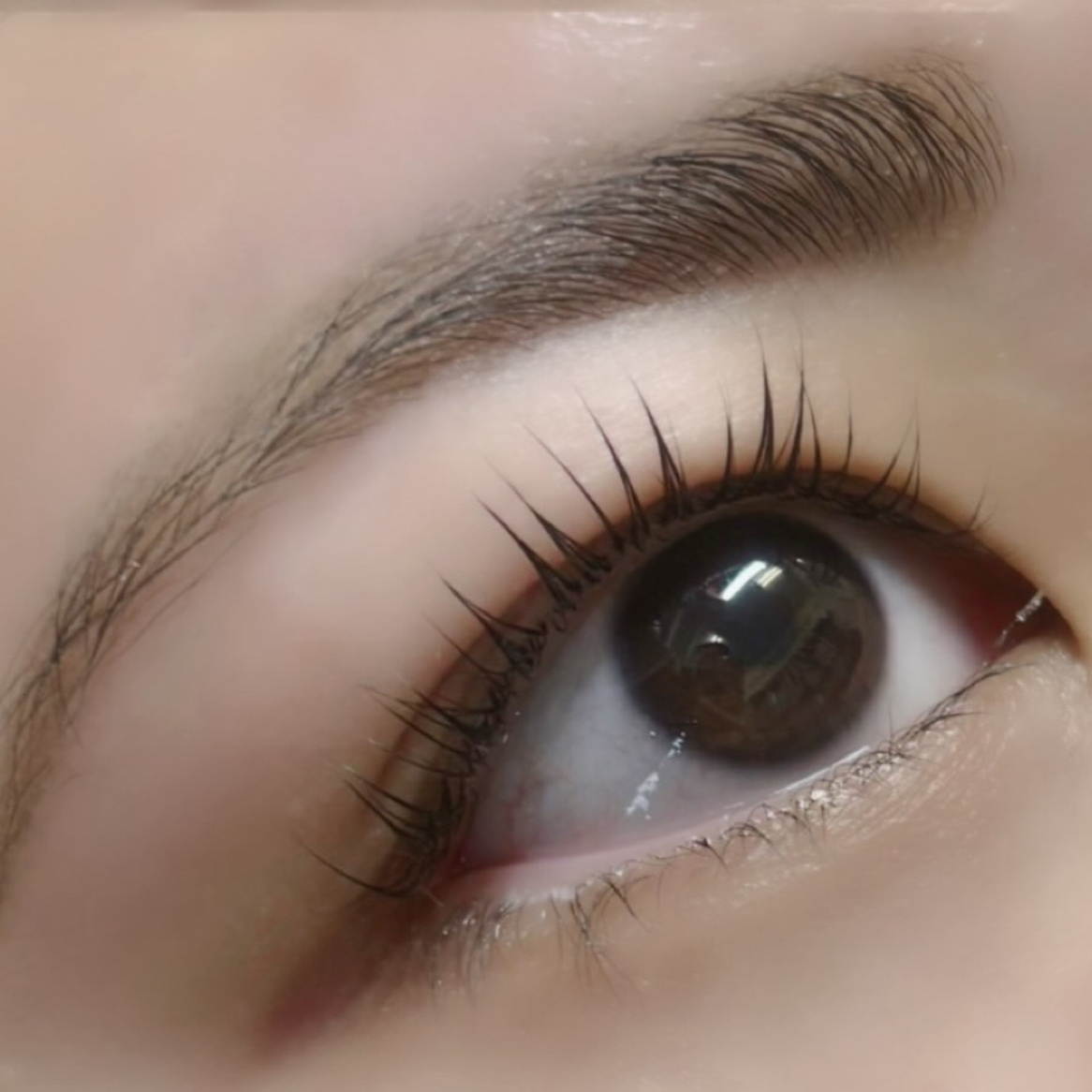 aoi__trueye
