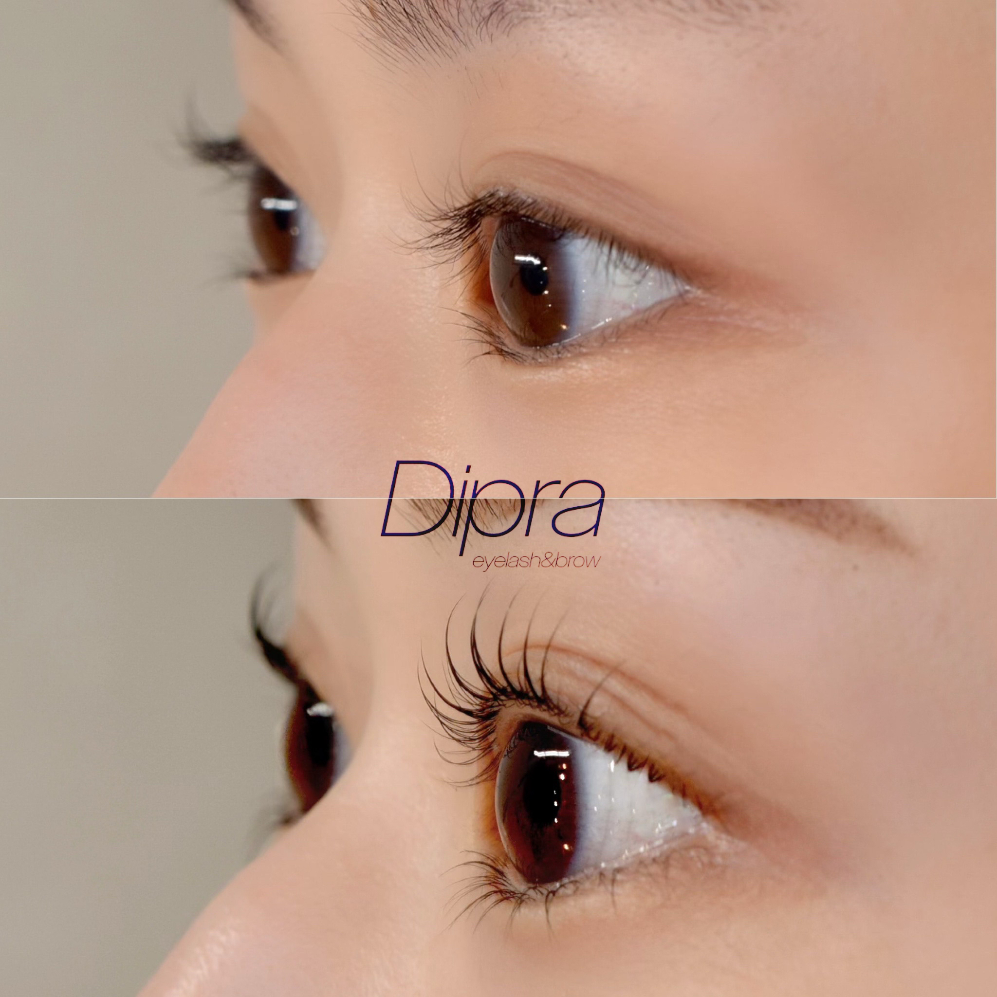dipra.eye