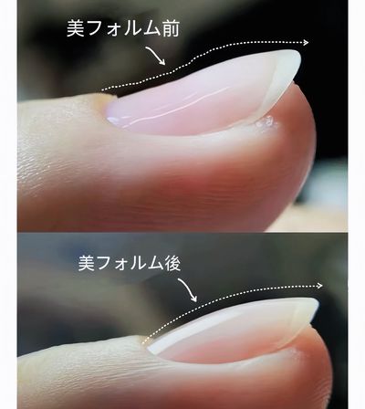 【育成系】自爪ケア＋クリア／ナチュラル♪傷んだ爪をリセット｜自爪育成コース