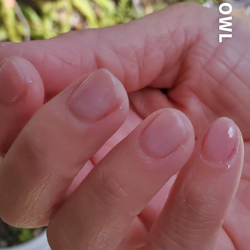 kitsu-nail