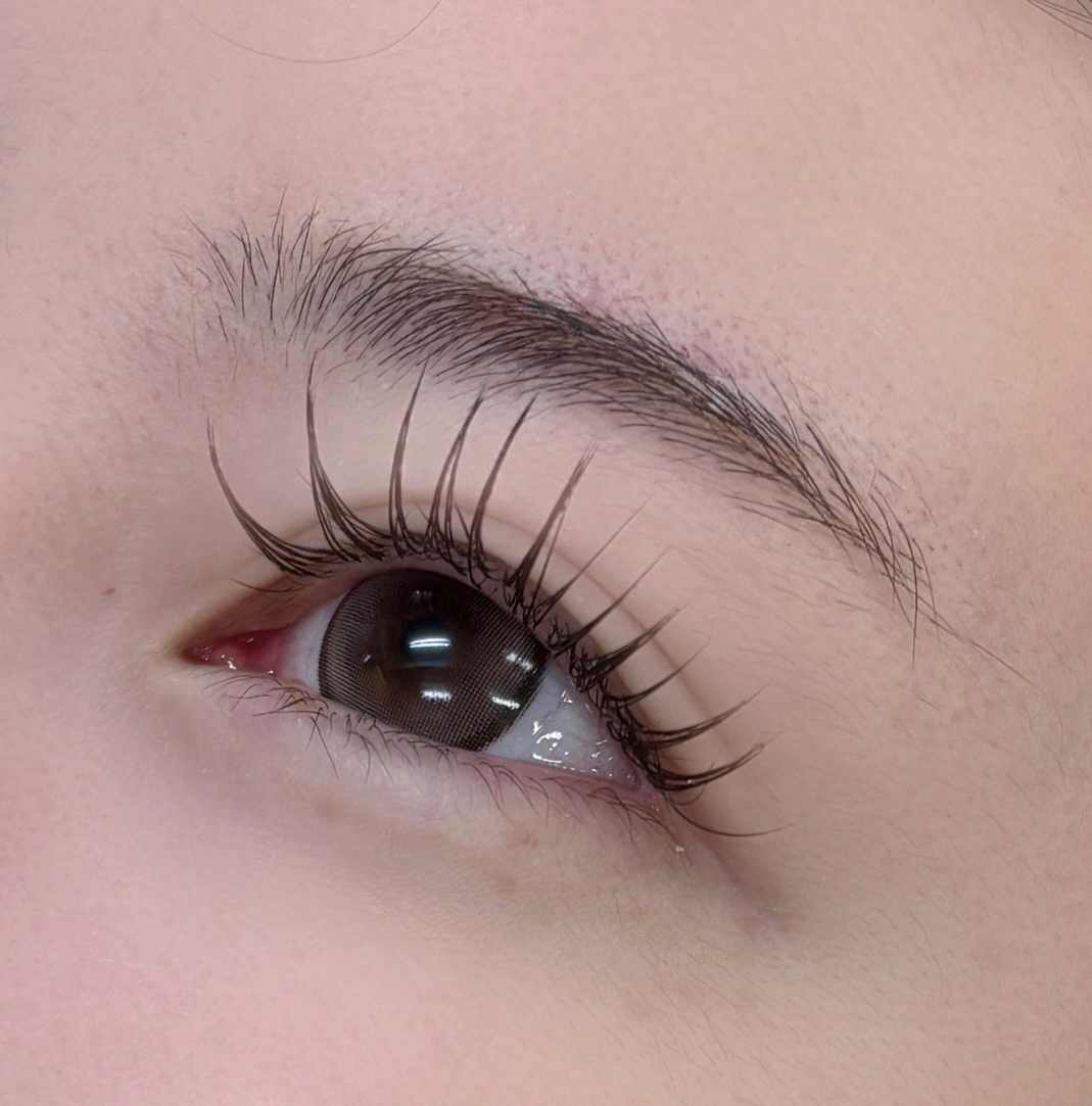 aoi__trueye
