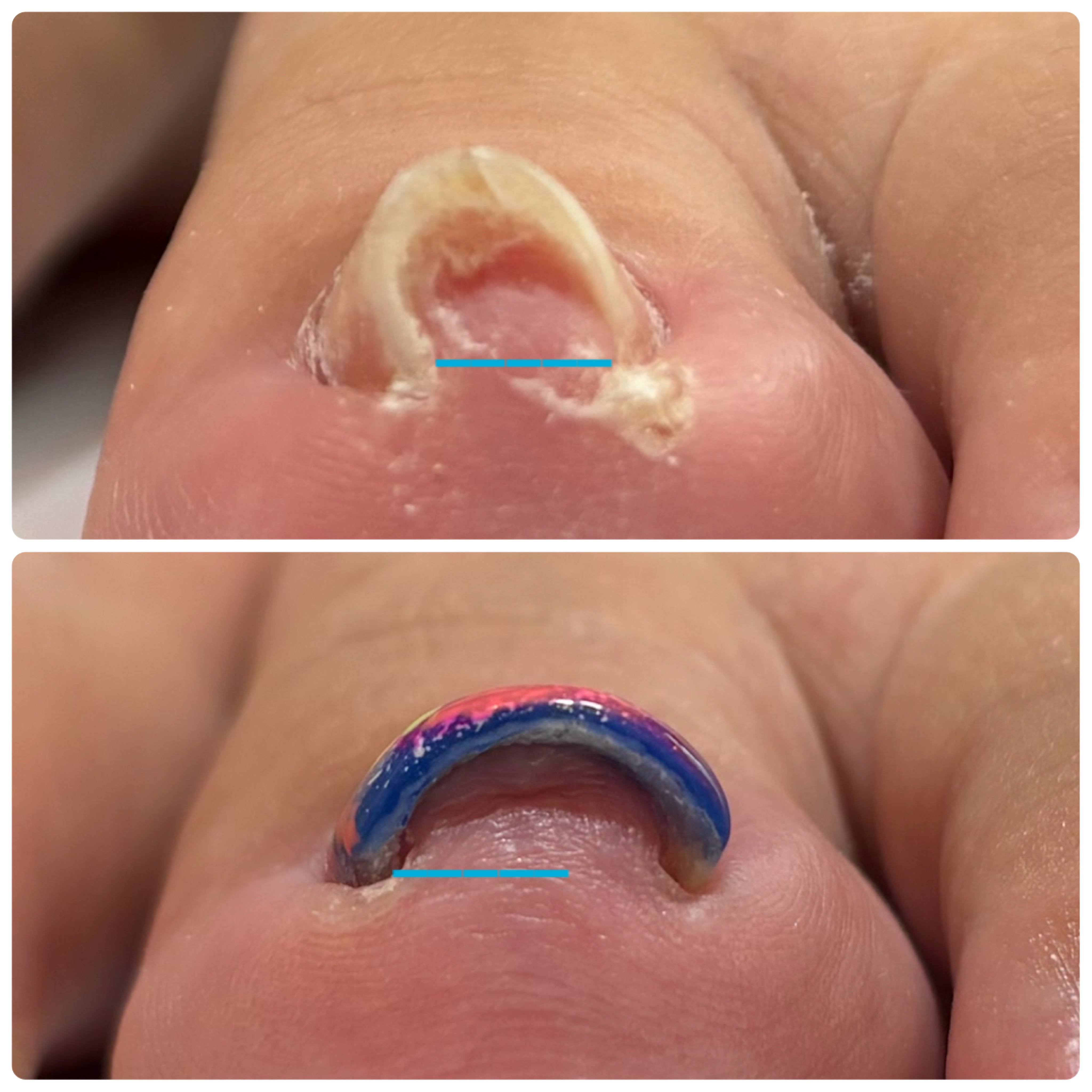 nail_abientot