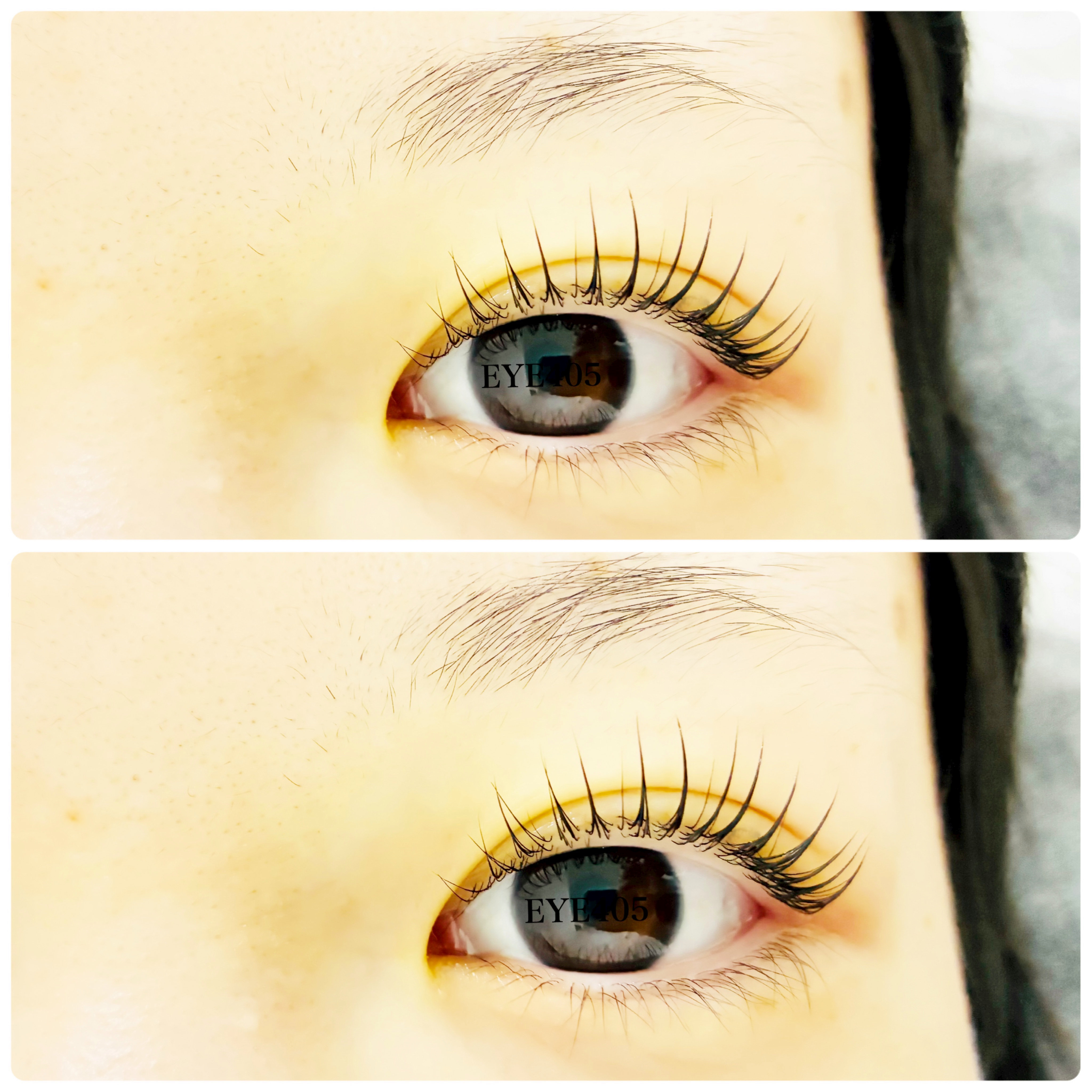 iga_EYE405