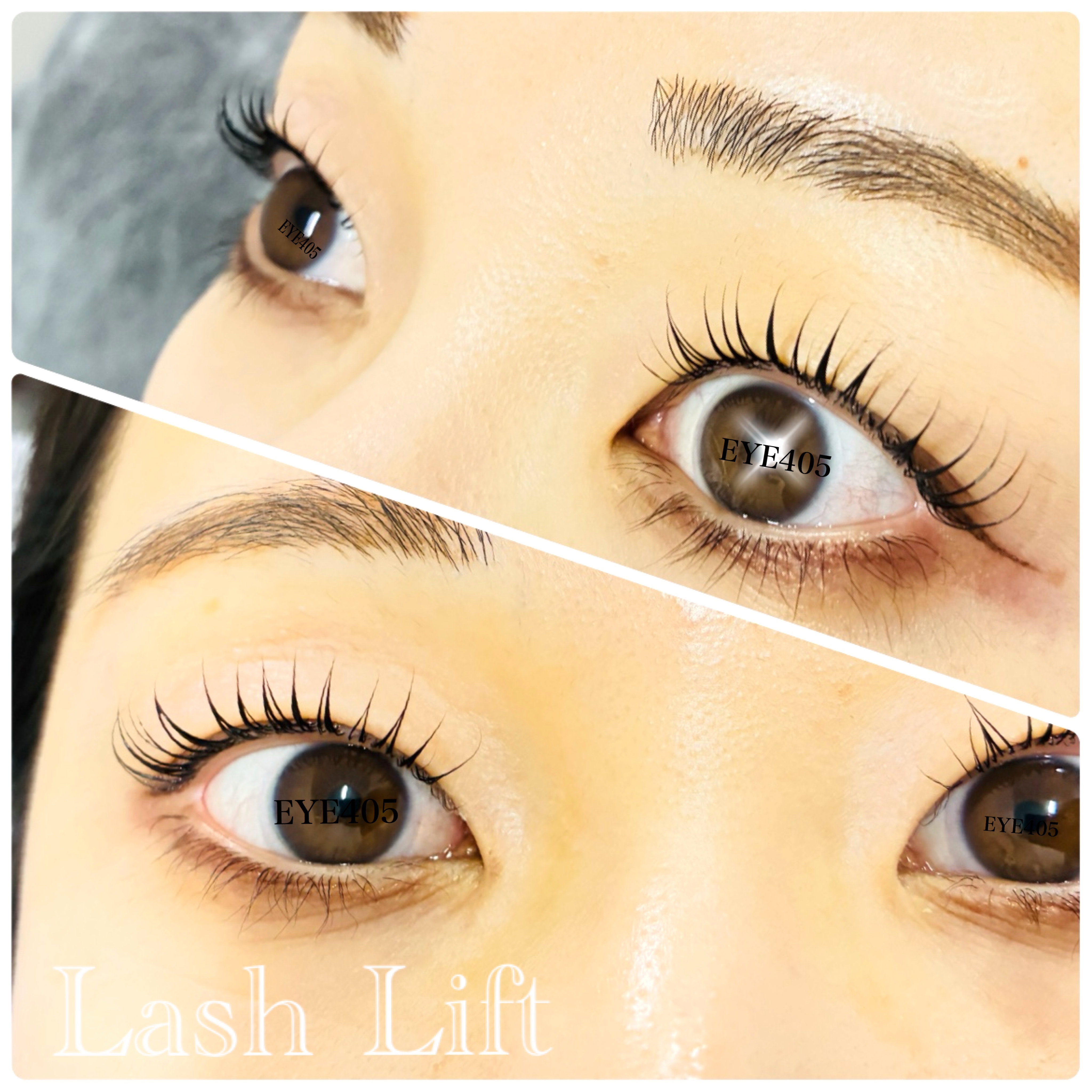 iga_EYE405