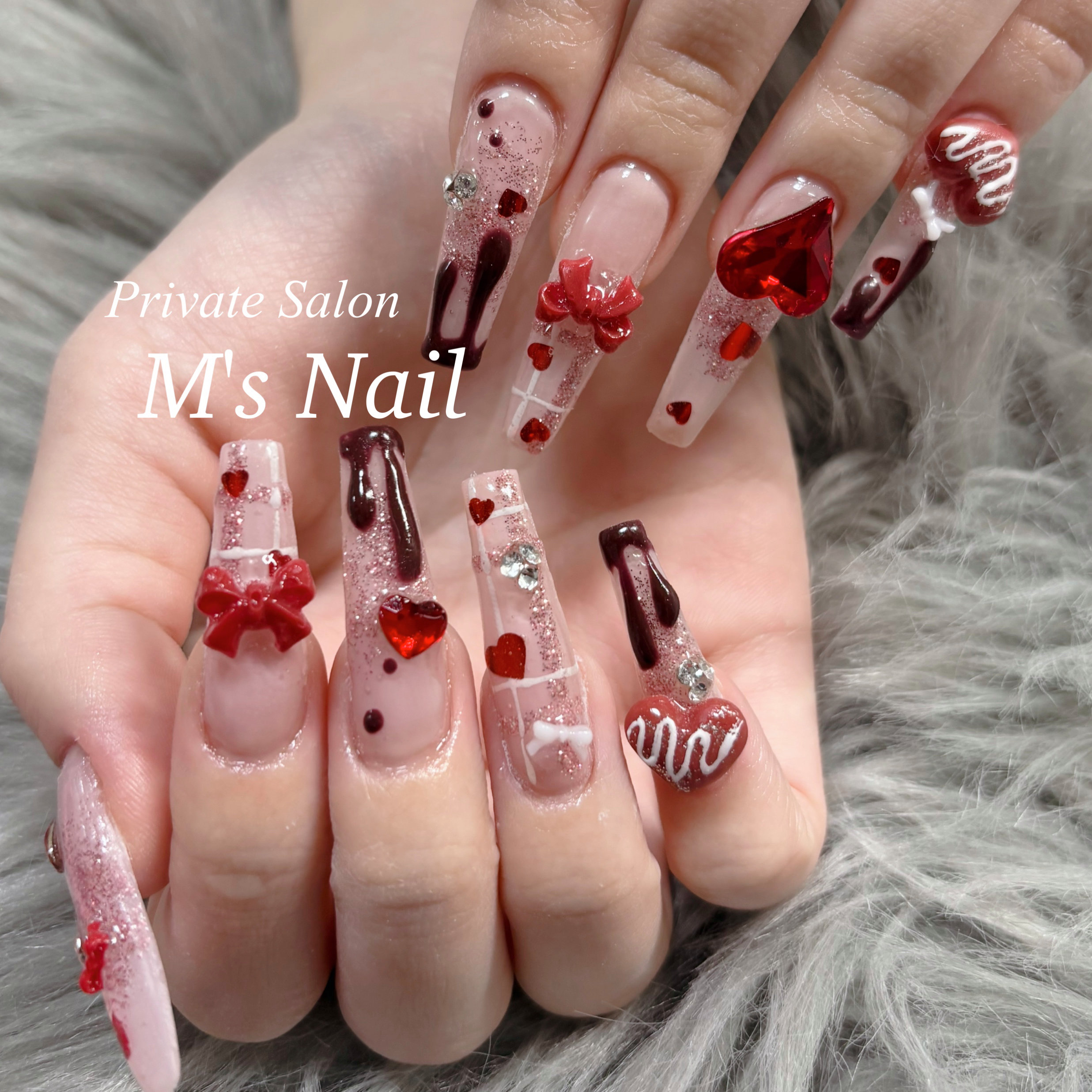 M.sNail