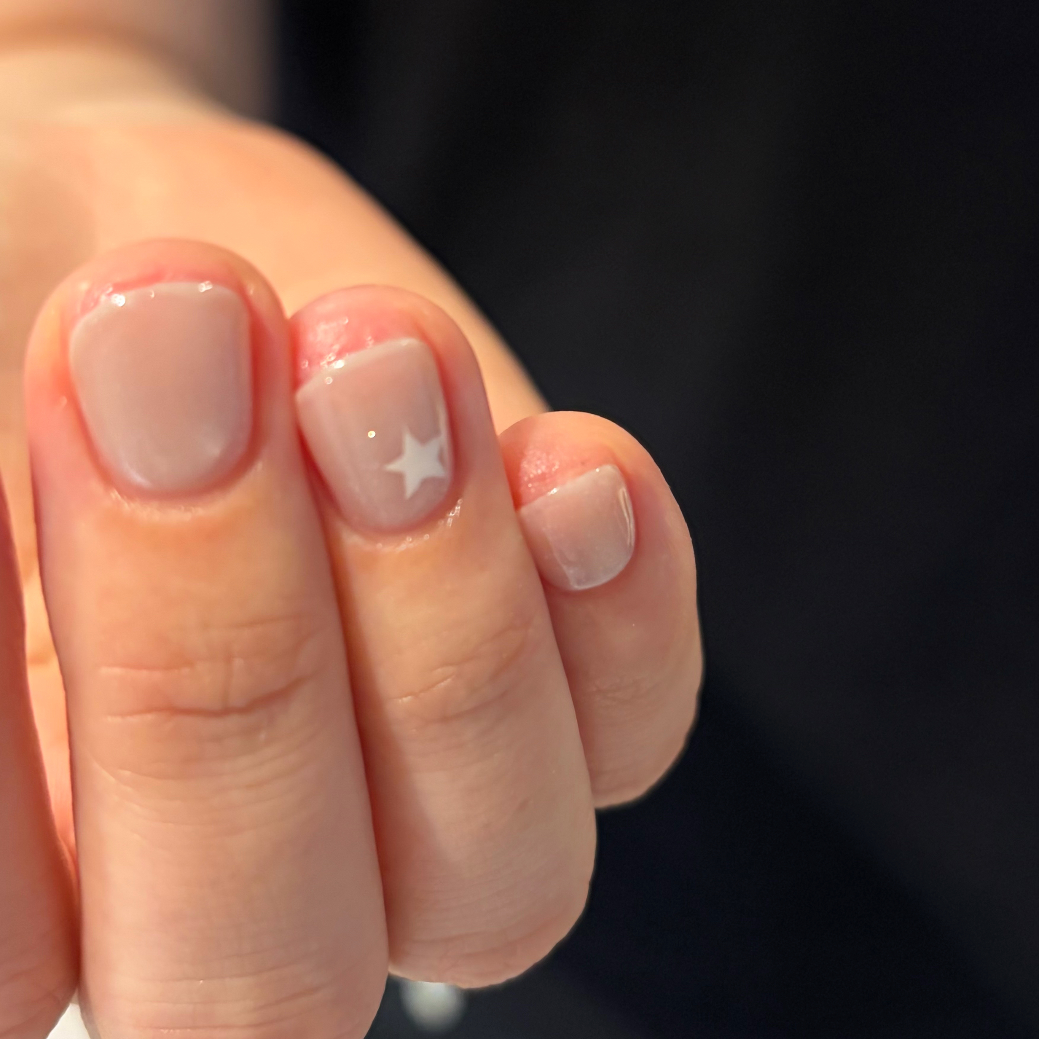 ymnail_