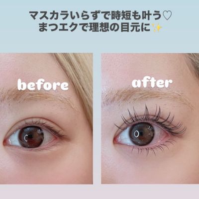 【上】バインドロック100束