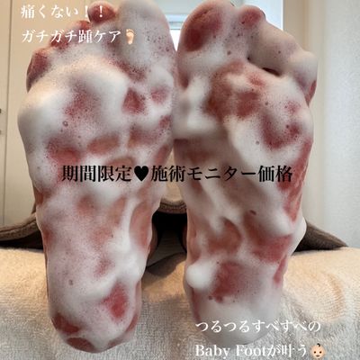 つるつる足裏角質ケア
