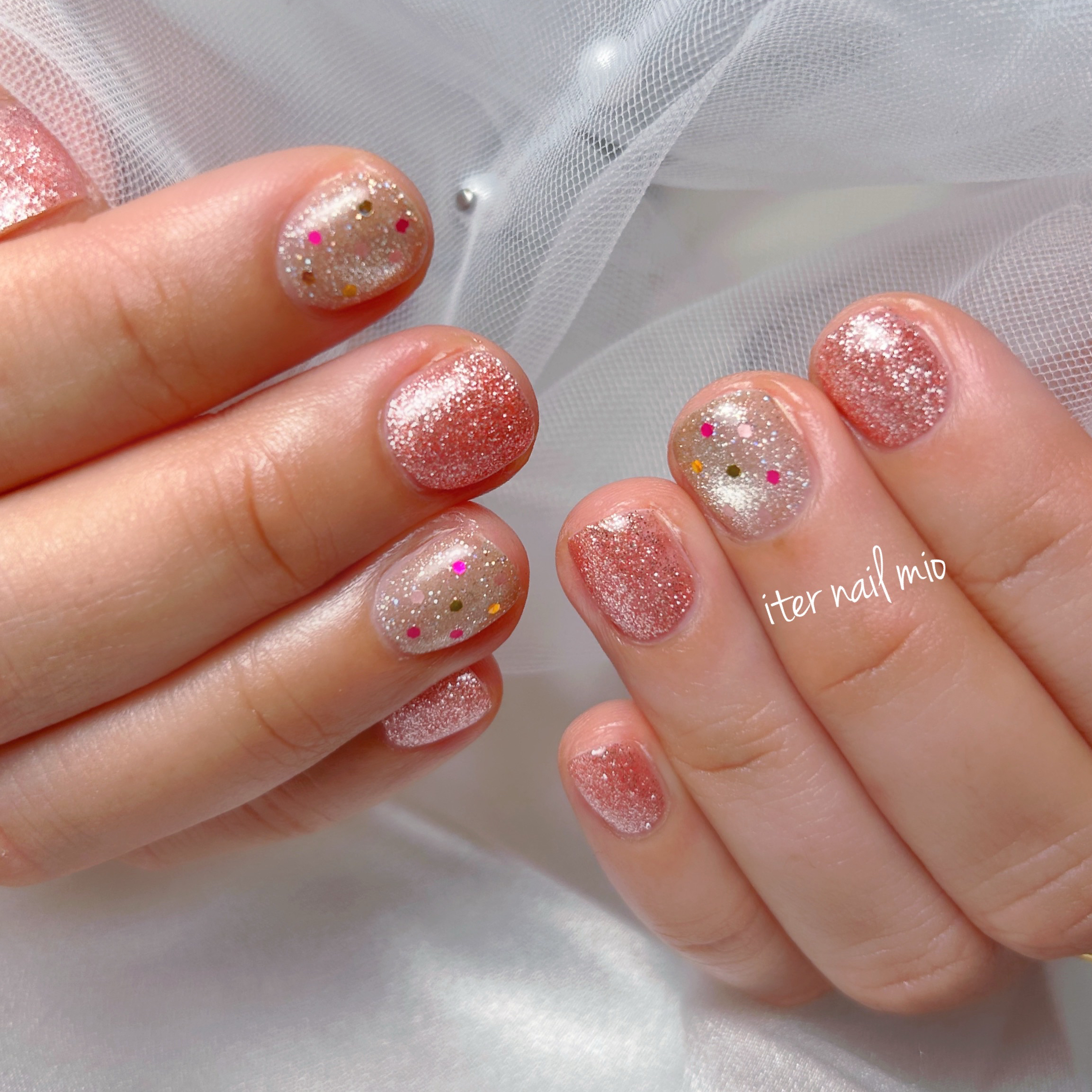 iter_nail_mio