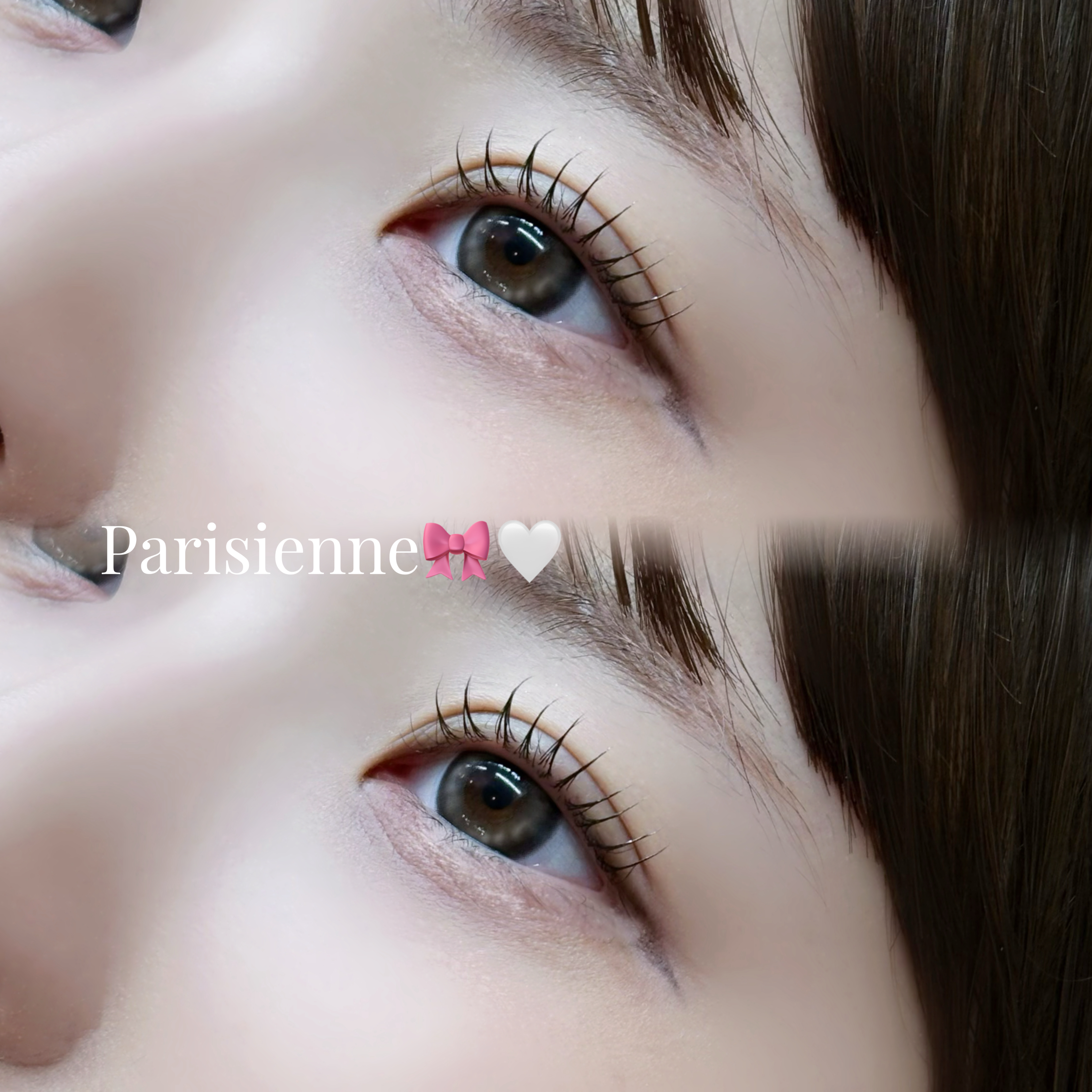 t.rin_trueye